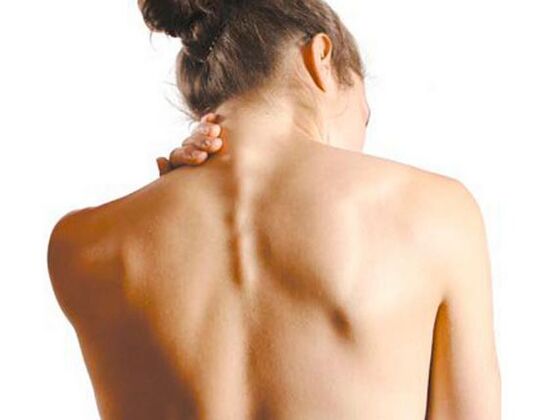 Tá osteochondrosis ceirbheacsach ag an gcailín