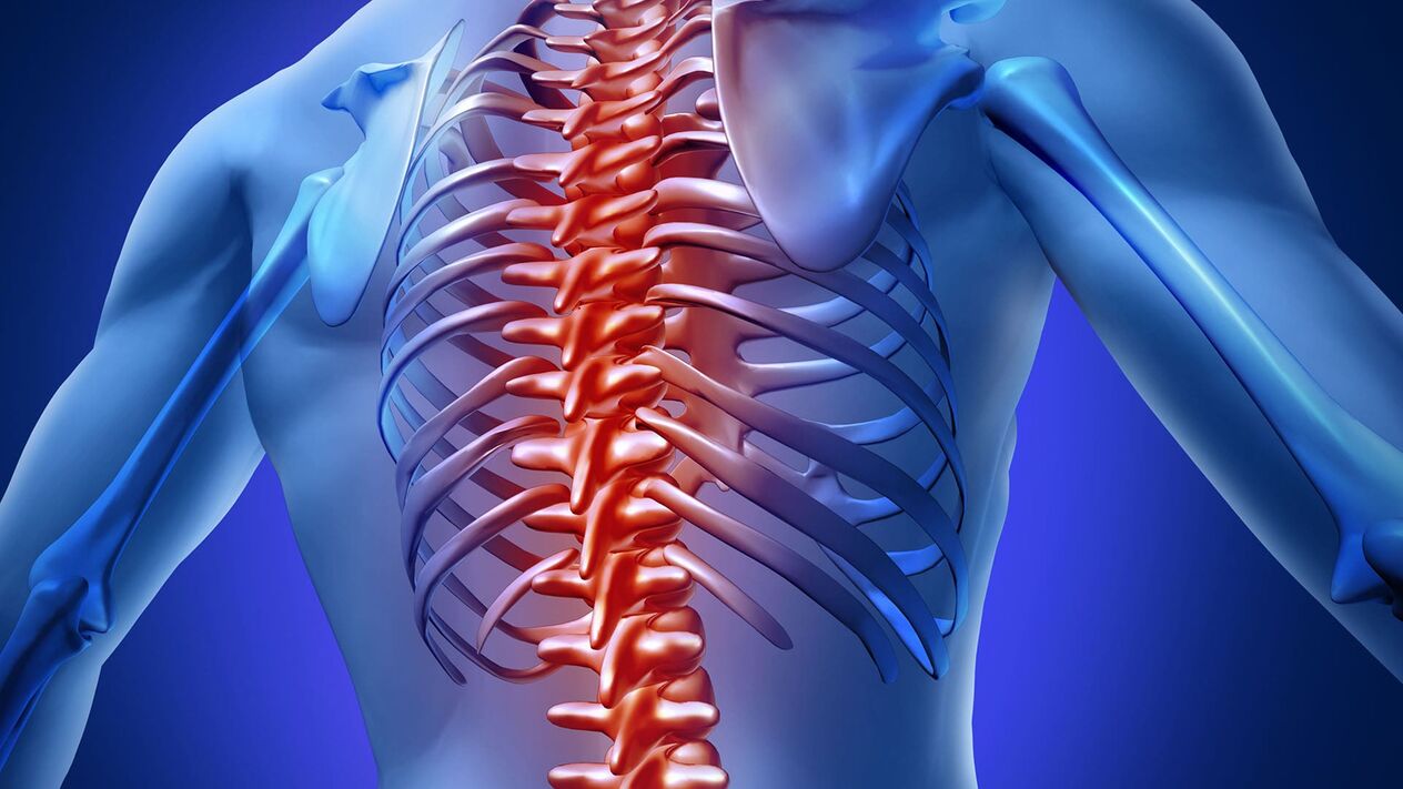 Osteachondrosis thoracic